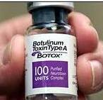 Botoxla Makat Çatlağı tedavisi