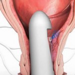 izmir THD ameliyatı