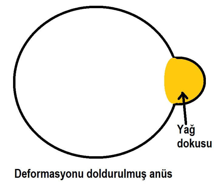 Yağ dokusu ile dışkı kaçırma önlenir