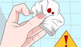 Hemoroid Belirtileri